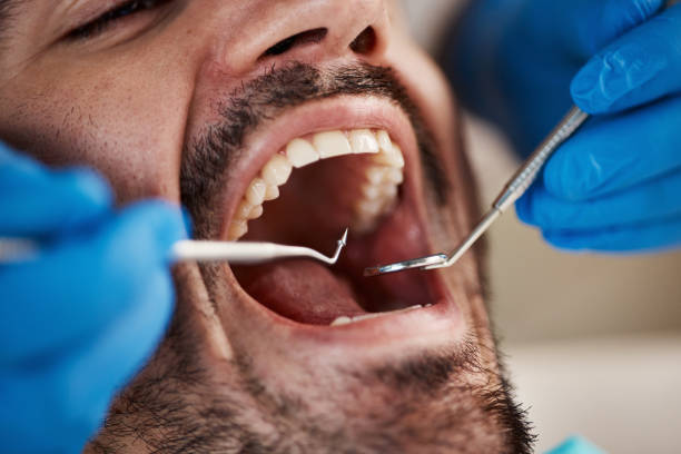 Best Cracked Tooth Emergency Dentist  in Wiggins, MS