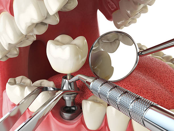 Professional Emergency Dentist in MS